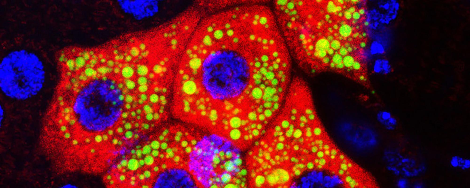 Larval Oenocytes. LipidTOX (green), Streptavidin (red), DAPI (blue). Annick Sawala & Alex Gould